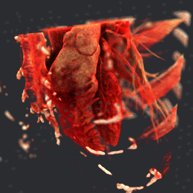 ../_images/cinematic_heart_thumbnail.png